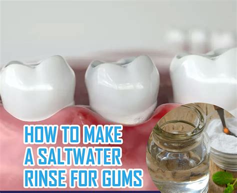 salt spray dental cleaning|salt water rinse for gums.